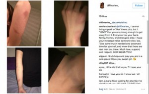 Ezekiel Elliott's Girlfriend Posts Photos Of Bruises, Claims She's A Victim Of Domestic Violence